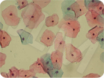 Cellules du col (étalées sur une lame) vues au microscope